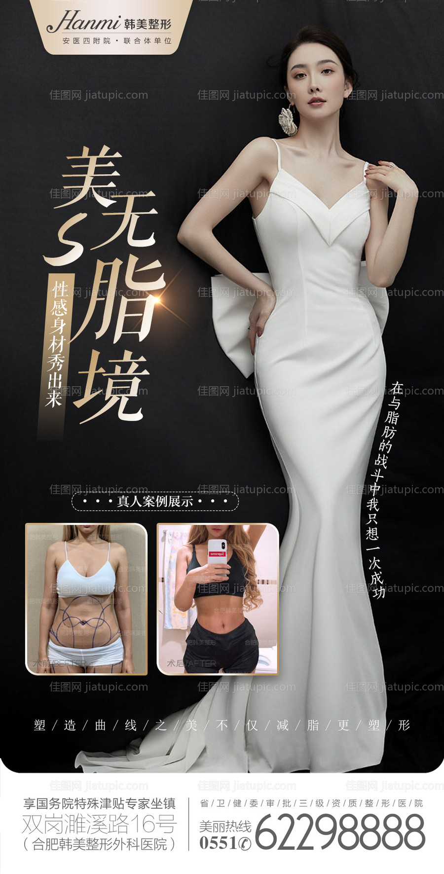 医美抽脂海报-源文件
