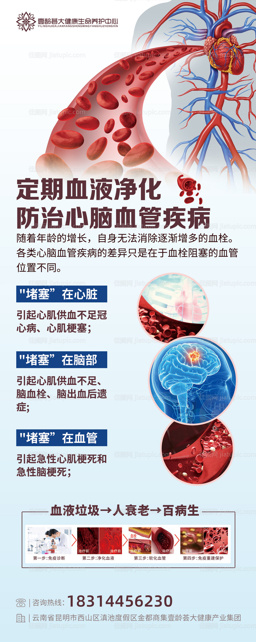 血液净化医疗展架-源文件