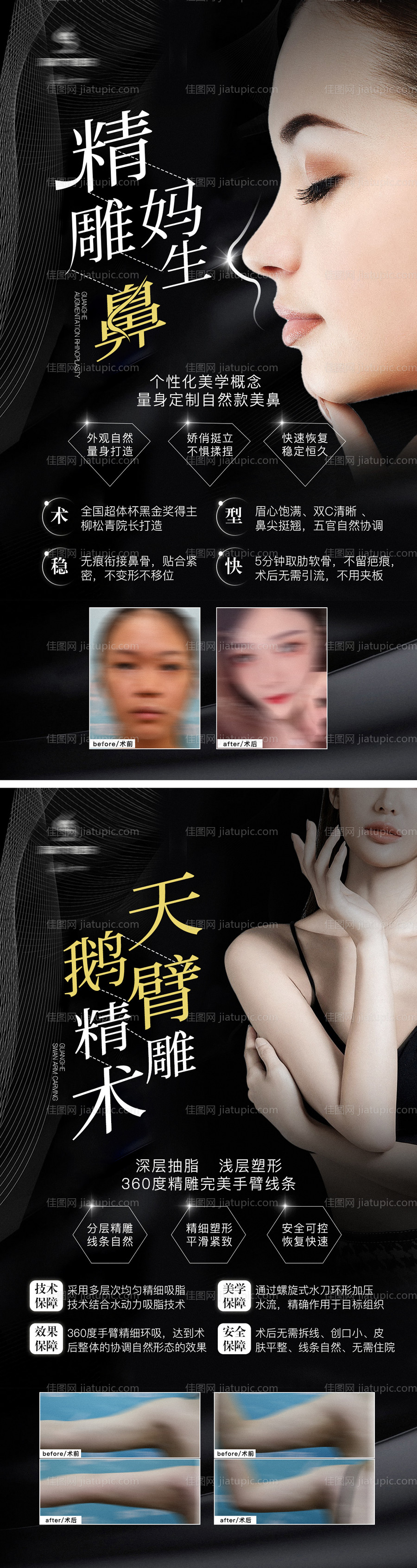 医美隆鼻吸脂项目介绍海报-源文件
