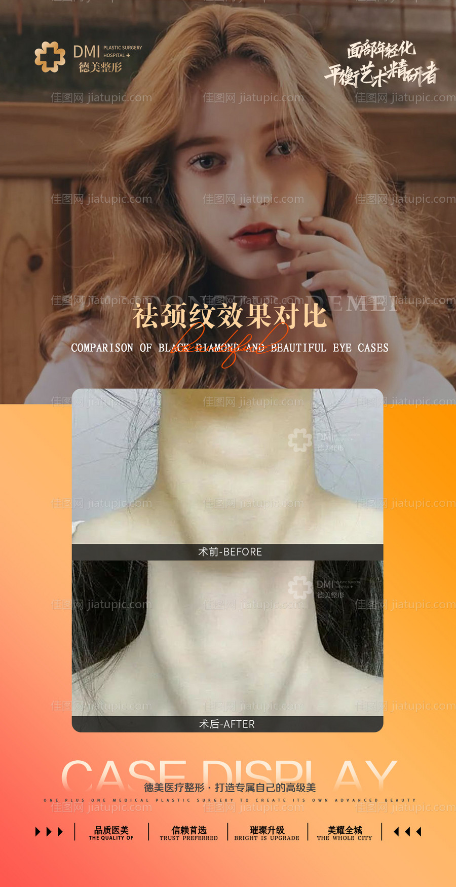 医美案例整形对比图祛颈纹下巴海报-源文件