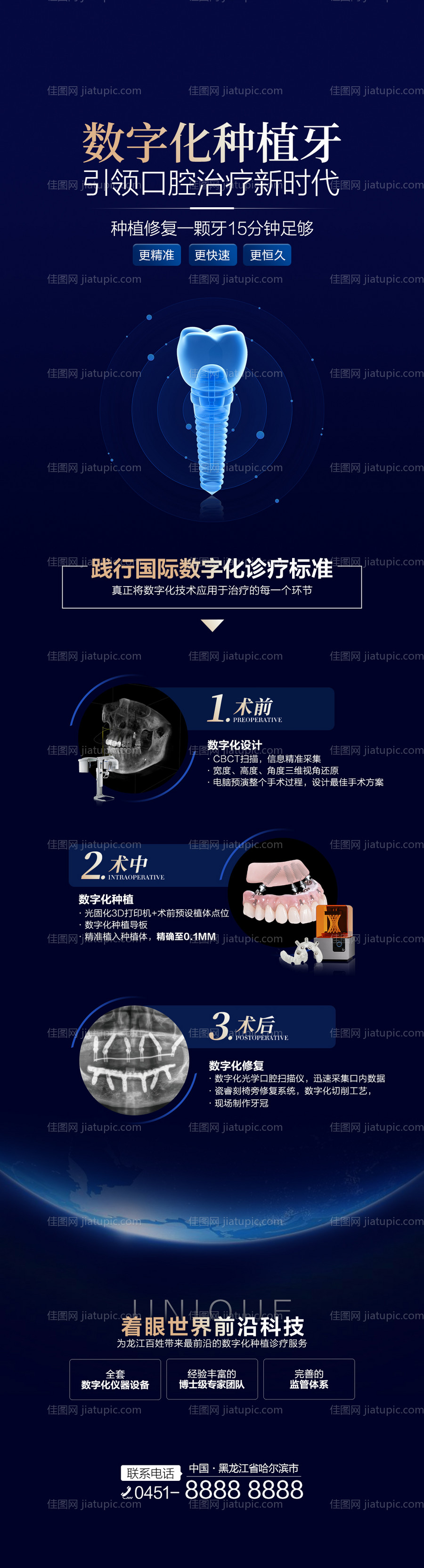 种植牙长图-源文件